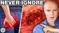 10 Early Signs of Colon Cancer You Must Not Ignore