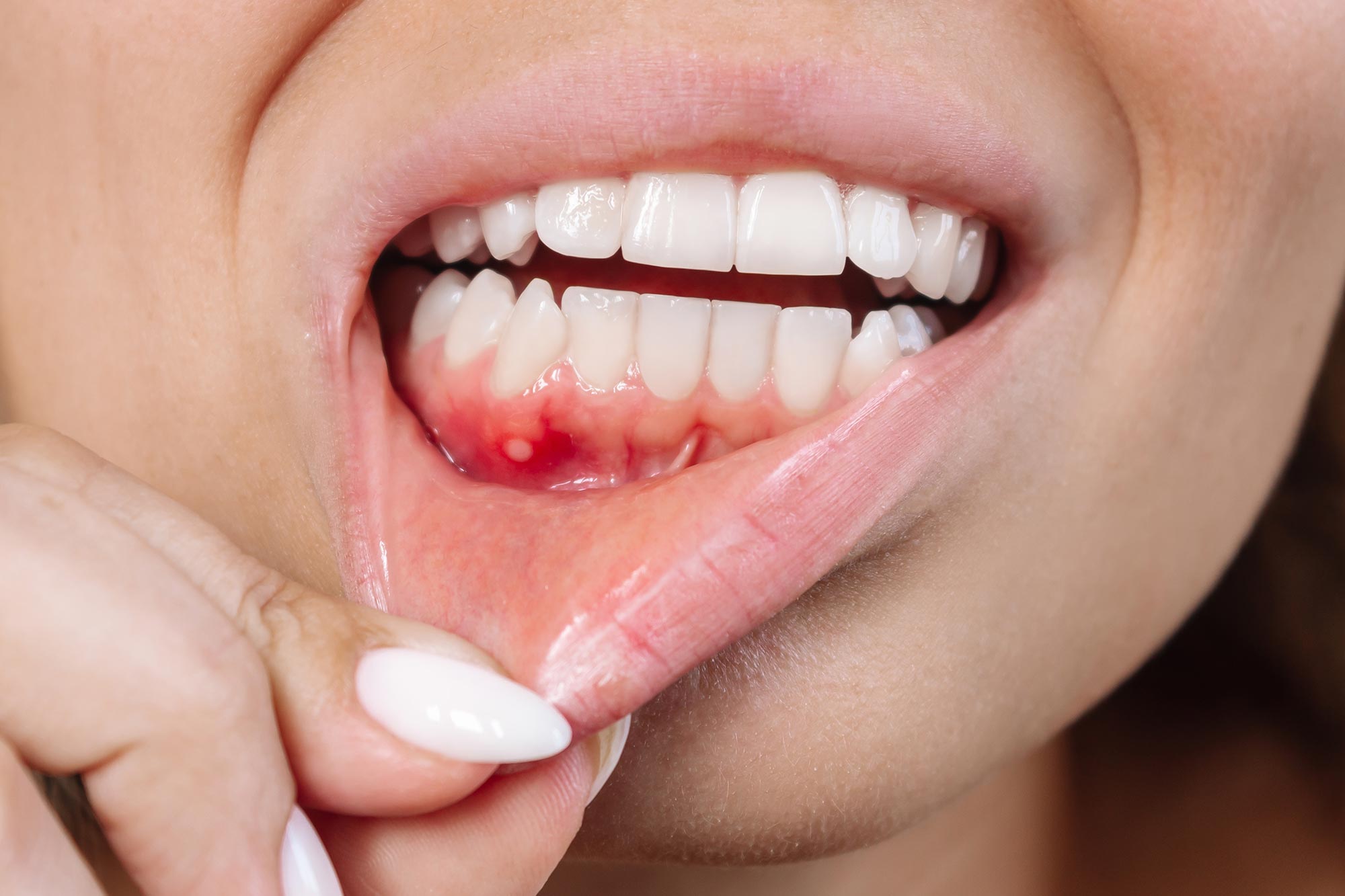 This Common Dental Issue May Endanger Your Brain Health