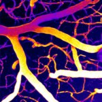 Brain Discovery Suggests New Approach for Dementia Treatment