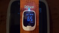 Ketone and Glucose Levels Following a 36-Hour Dry Fast