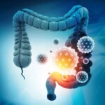 Immune Chain Reaction Increasing Colon Cancer Risk in IBD
