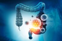 Immune Chain Reaction Increasing Colon Cancer Risk in IBD