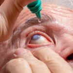 Doctors Caution: Popular Eye Ointment May Harm Glaucoma Implants