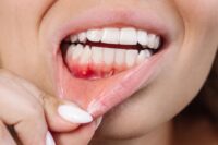 Can Tomato Nutrients Help Prevent Gum Disease in Seniors?