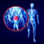 Stanford Study: Colorblindness Could Mask Cancer Warning Signs
