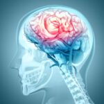 This Condition Quadruples Dementia Risk, Yet Few Know It