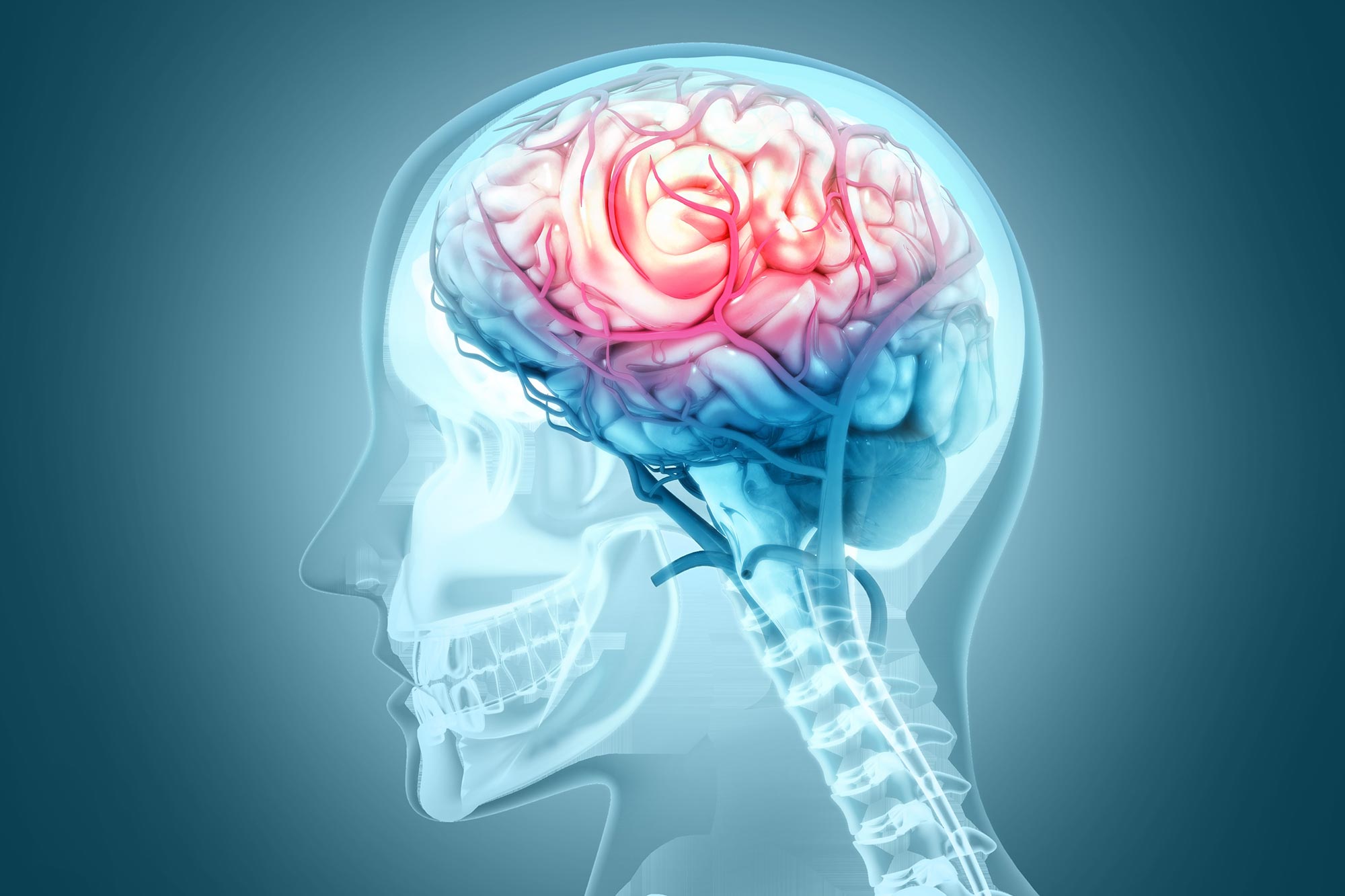 This Condition Quadruples Dementia Risk, Yet Few Know It