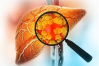 Naturally Occurring Compound Could Help Prevent Liver Disease