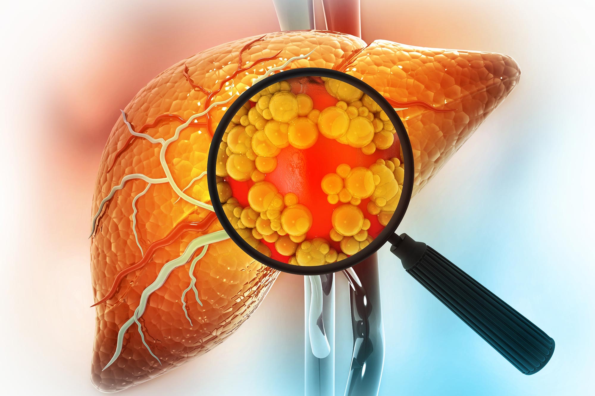 Naturally Occurring Compound Could Help Prevent Liver Disease