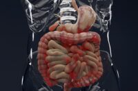 Stanford Study Reveals Diet to Alleviate Crohn’s Symptoms