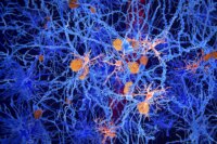 Scientists Discover Preventable Early Stage of Alzheimer’s