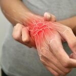 Scientists Reveal How Psoriasis Develops Into Joint Pain Disease