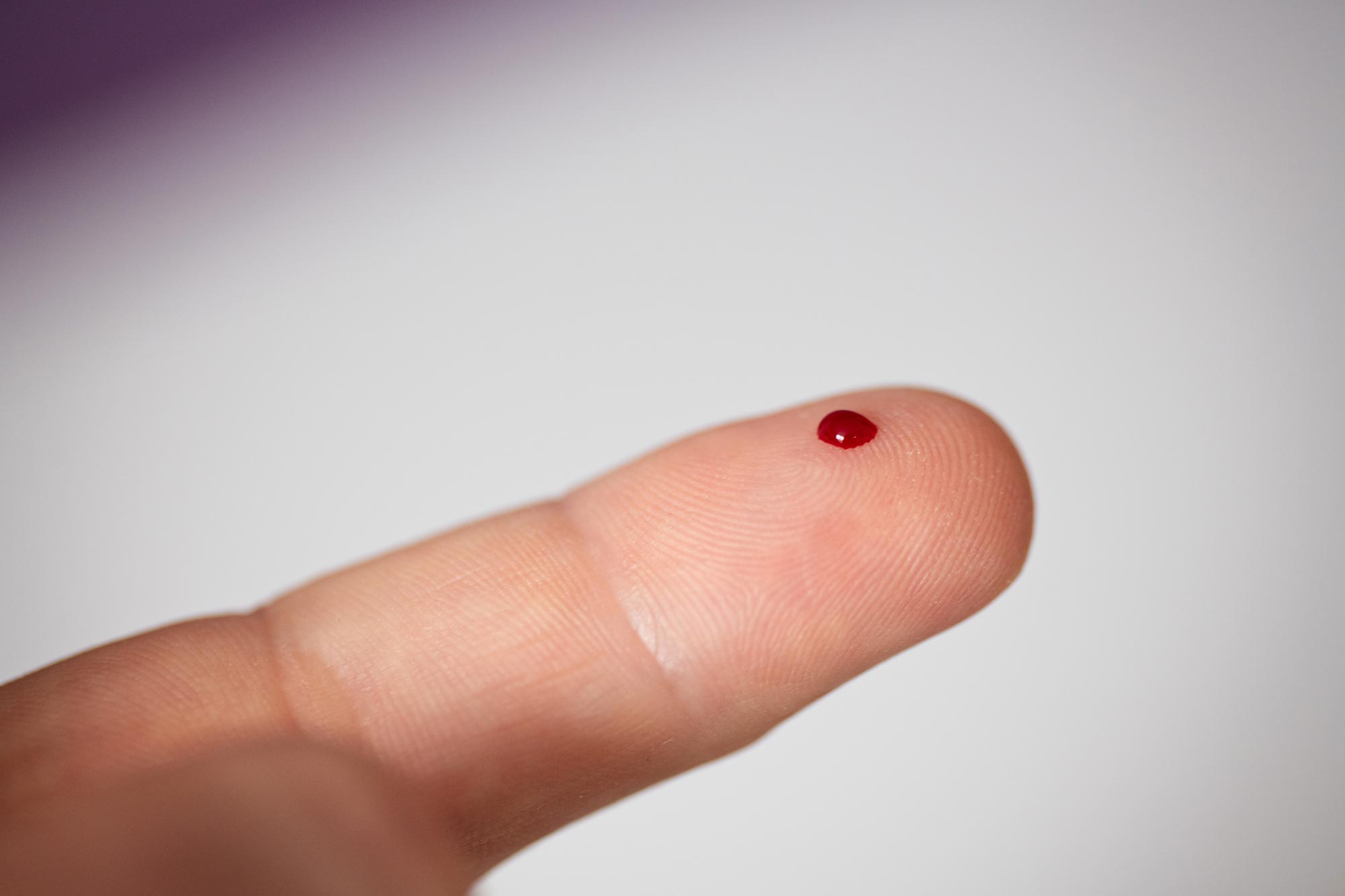 New Blood Test Detects Cancer Before Tumors Form