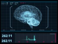 AI Diagnoses Brain Disorders Rapidly and Accurately