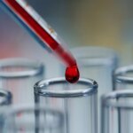 Breakthrough Blood Test May Detect Pancreatic Cancer Early