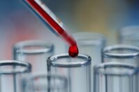 Breakthrough Blood Test May Detect Pancreatic Cancer Early
