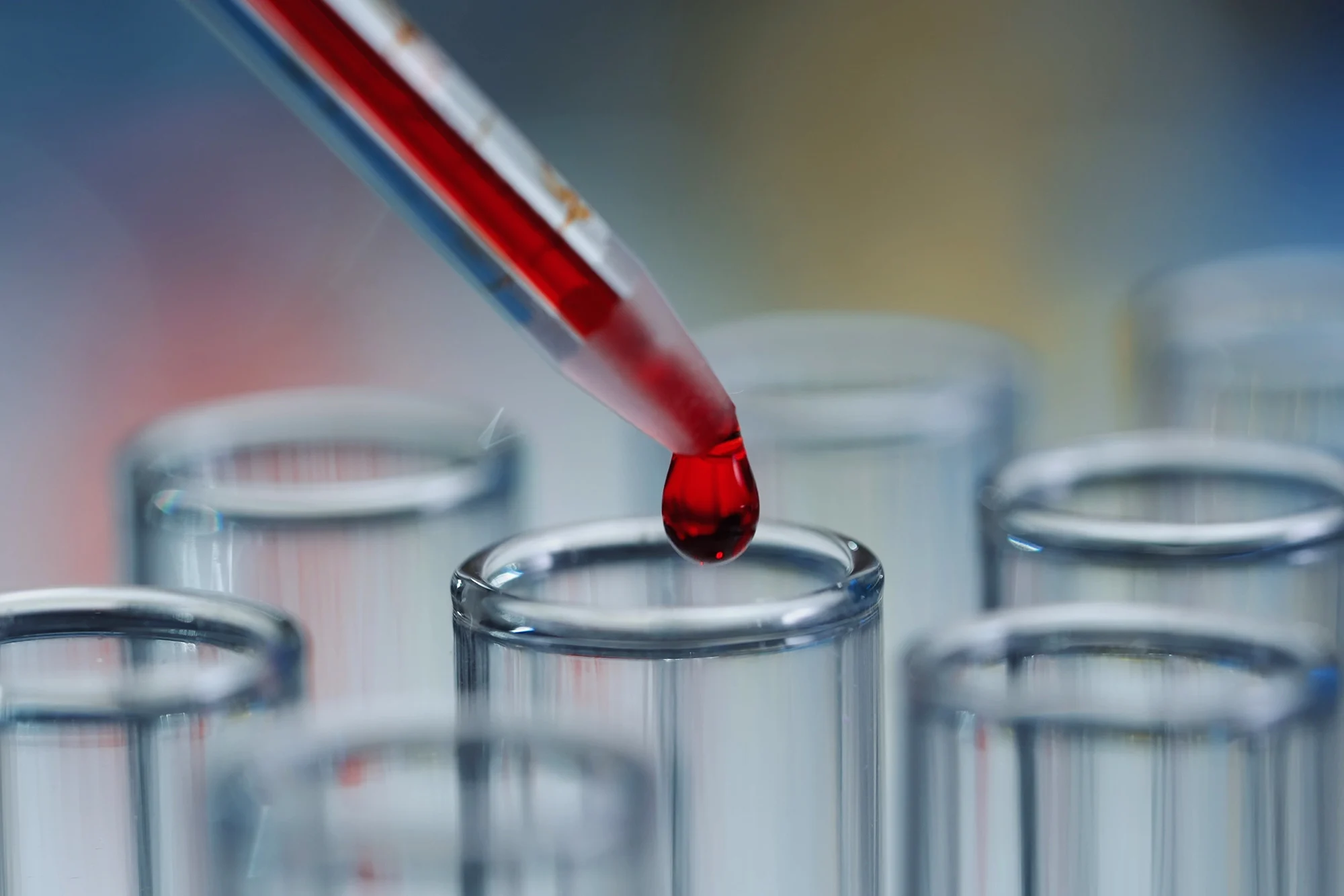 Breakthrough Blood Test May Detect Pancreatic Cancer Early