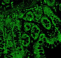 Low-Dose THC May Safeguard Gut and Liver Health in HIV