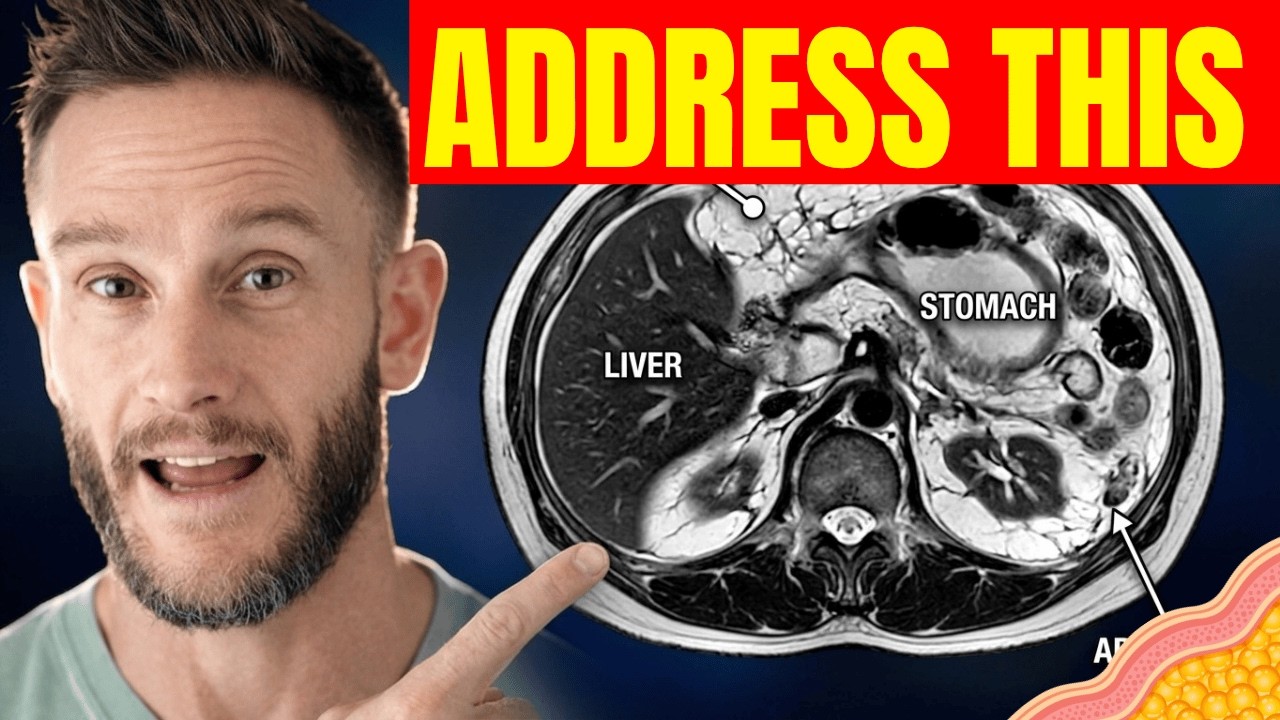 How Visceral Fat Affects Your Brain and How to Stop It