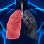 How Aging Lungs Elevate Mild Infections to Severe Risks