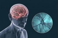 Rethinking Alzheimer’s Treatment: A Call from Scientists