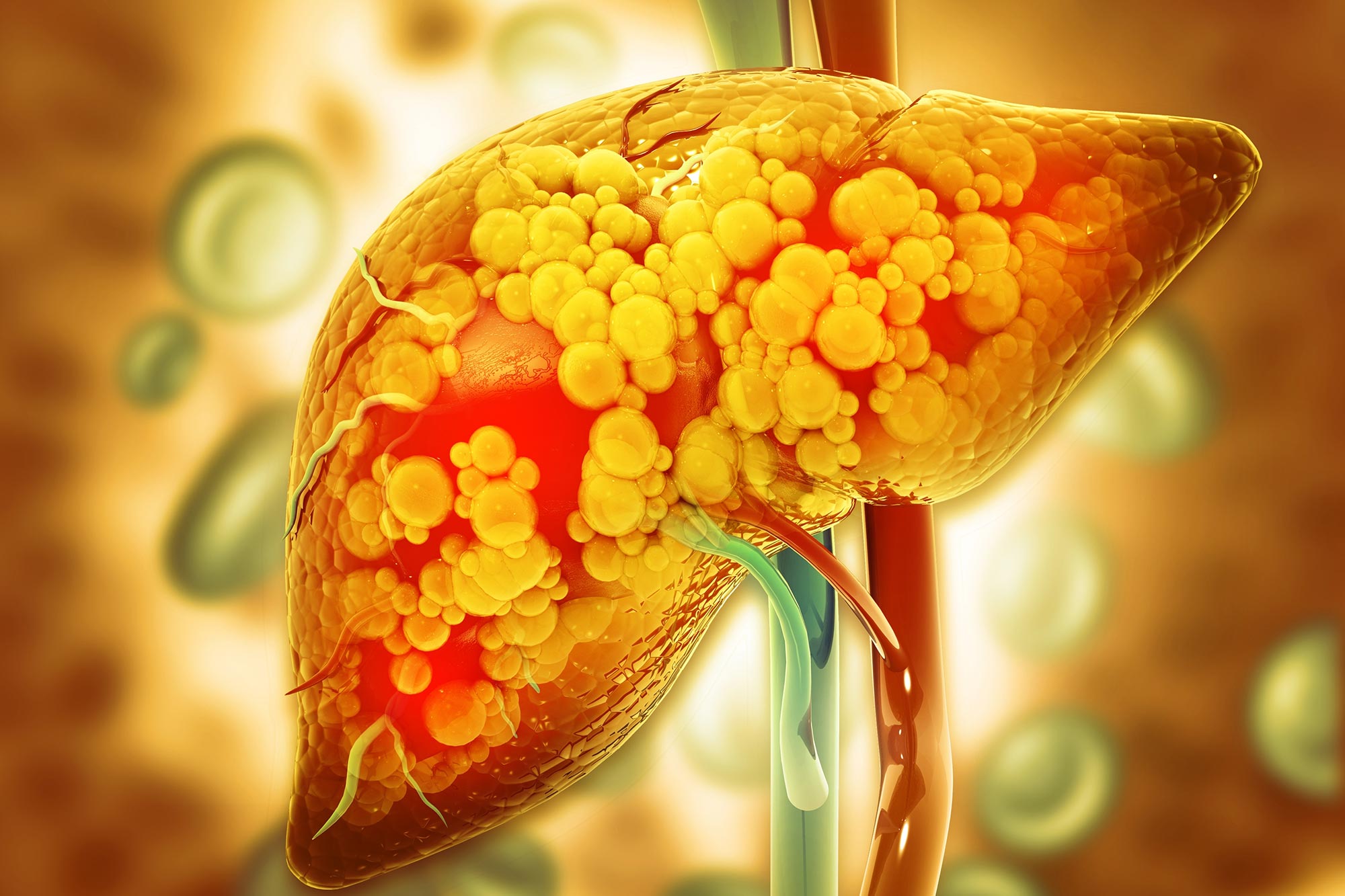 The Risks of Sugary Diets with Low Testosterone Levels