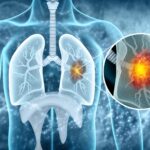 Scientists Discover Aging Connection That May Transform Cancer Treatment