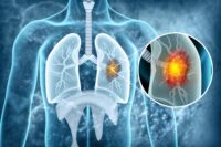 Scientists Discover Aging Connection That May Transform Cancer Treatment