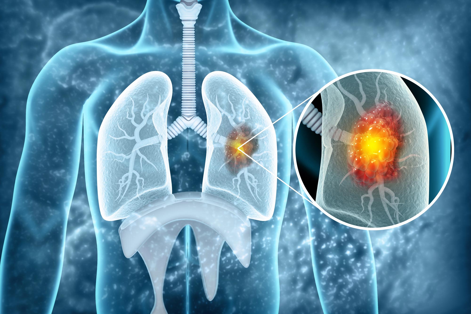 Scientists Discover Aging Connection That May Transform Cancer Treatment
