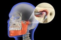 New Enzyme Discovery May Safeguard Jaw Cartilage and Halt Arthritis