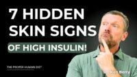 7 Skin Indicators of Insulin Resistance in Slim Individuals