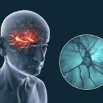 New Study Challenges Alzheimer’s Theories Beyond Plaques