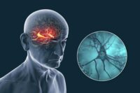 New Study Challenges Alzheimer’s Theories Beyond Plaques