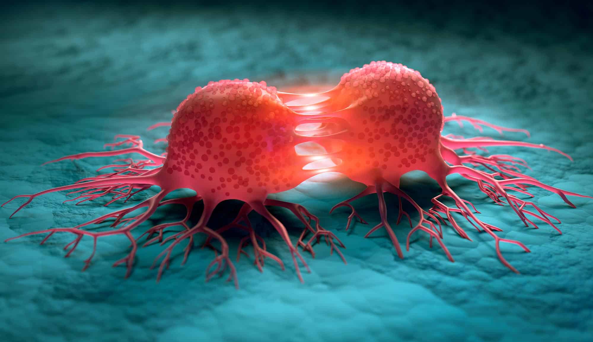 Rising Bowel and Ovarian Cancers in Young Adults: A Mystery