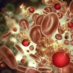 25-Year Study Reveals Key Indicators of Blood Cancer Risks