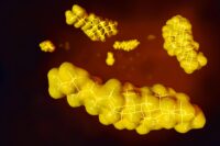 Scientists Unveil Breakthrough Treatment for High Cholesterol