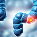 Hidden Virus Linked to Colorectal Cancer Discovered by Scientists