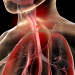 Hidden Early Warning Signs of Esophageal Cancer