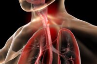 Hidden Early Warning Signs of Esophageal Cancer