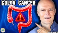 Top Strategies for Colon Cancer Prevention