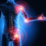 Could Low Vitamin D Be Aggravating Your Pain?