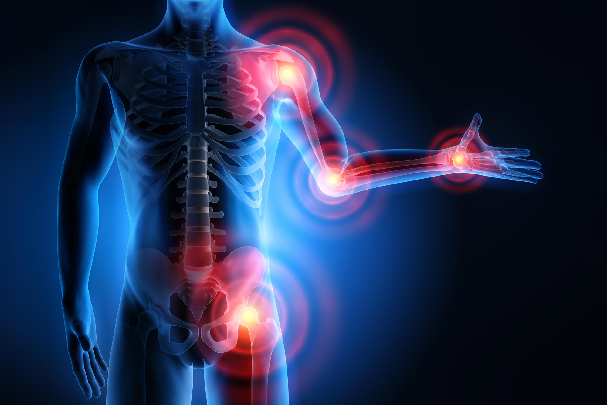 Could Low Vitamin D Be Aggravating Your Pain?