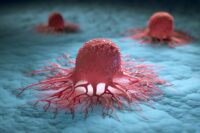 Cancer Mystery Unveiled: How Melanoma Achieves Immortality