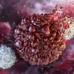 Scientists Prevent Pancreatic Cancer in Groundbreaking Study