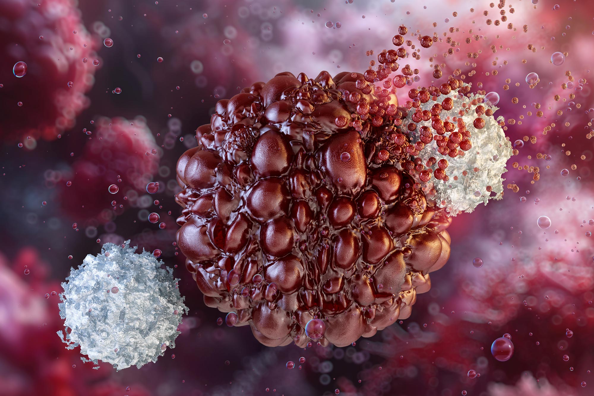 Scientists Prevent Pancreatic Cancer in Groundbreaking Study