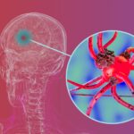 Breakthrough Strategy Emerges to Halt Parkinson’s Progression