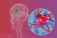 Breakthrough Strategy Emerges to Halt Parkinson’s Progression
