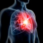 Study Warns: Hidden Heart Risk Affects 1 in 5 Individuals