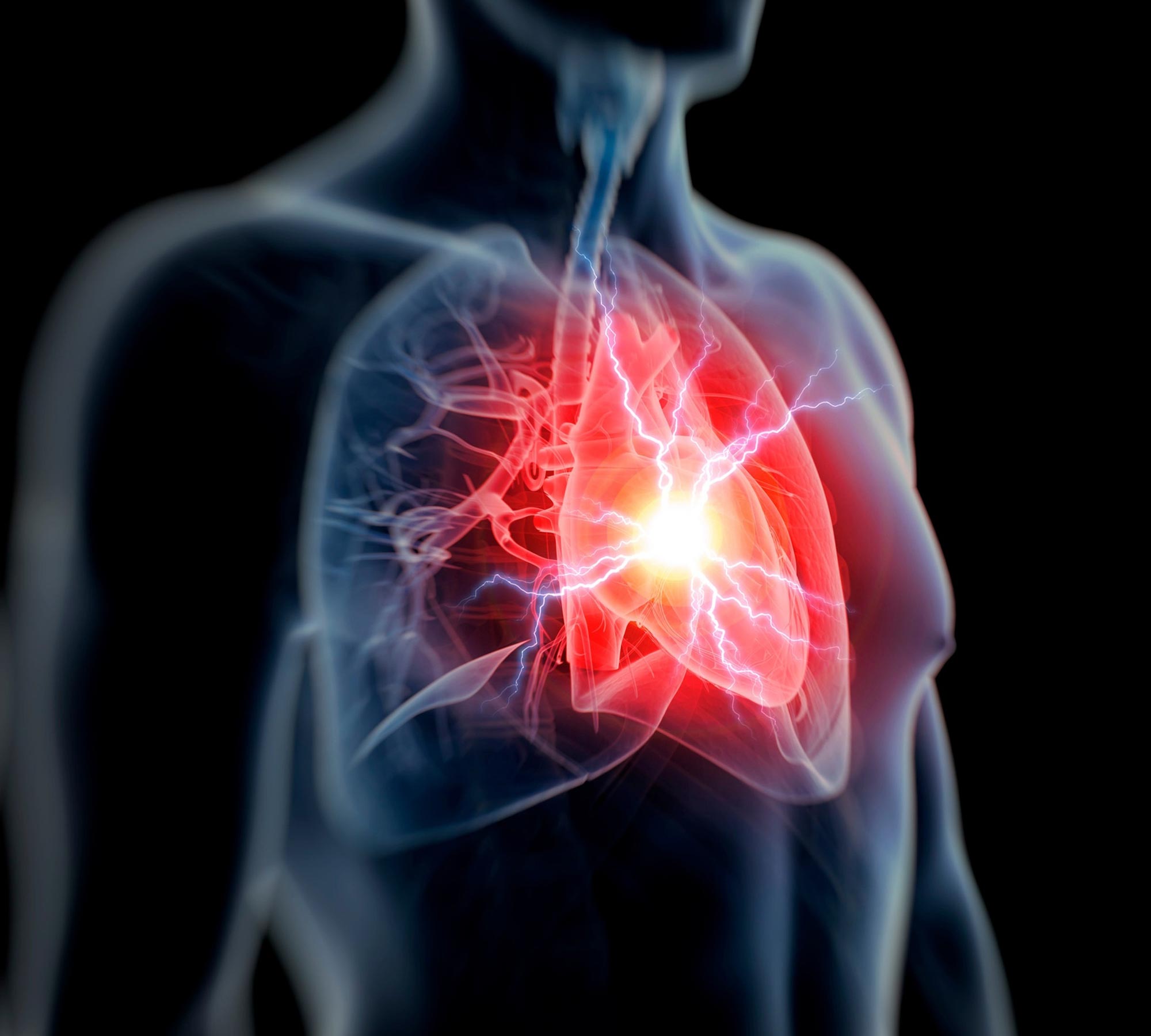 Study Warns: Hidden Heart Risk Affects 1 in 5 Individuals