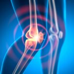 New Discoveries in Rheumatoid Arthritis: Beyond Inflammation